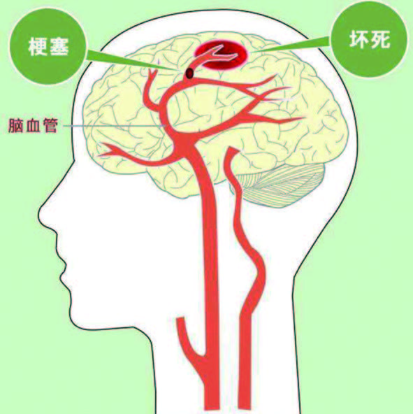 大脑血液循环ppt图片
